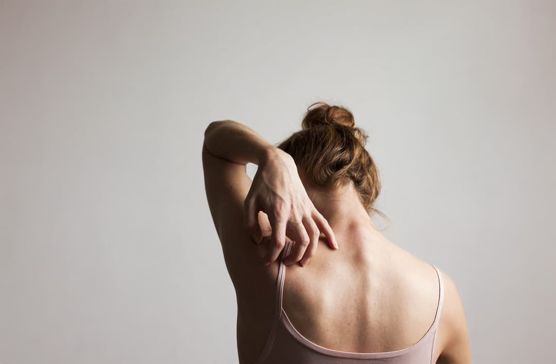 Why does my skin itch?